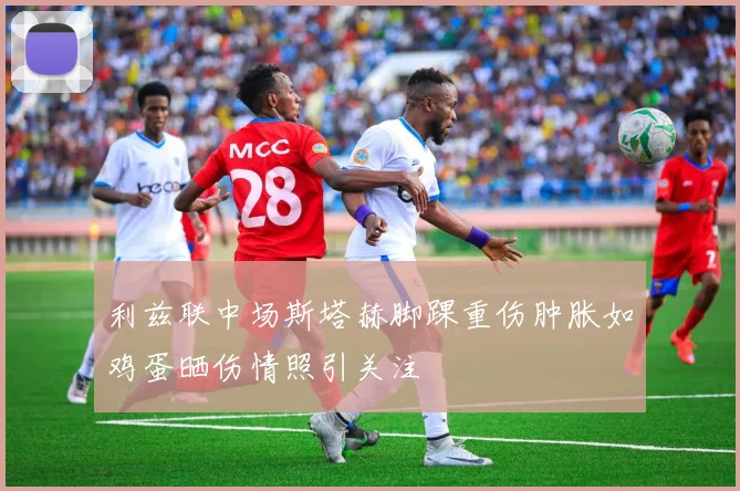 利兹联中场斯塔赫脚踝重伤肿胀如鸡蛋晒伤情照引关注